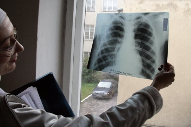 Узбекистан начал производить собственные рентген-аппараты