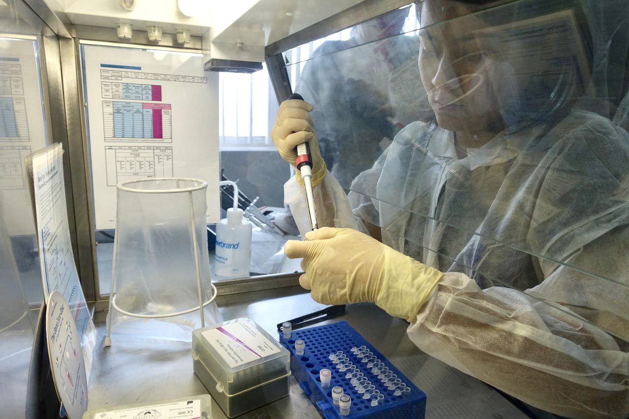 Узбекистан внедряет молекулярно-генетические методы тестирования для борьбы с туберкулезом