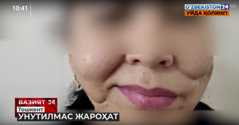 В Ташкенте мужчина порезал бритвой лицо своей жены