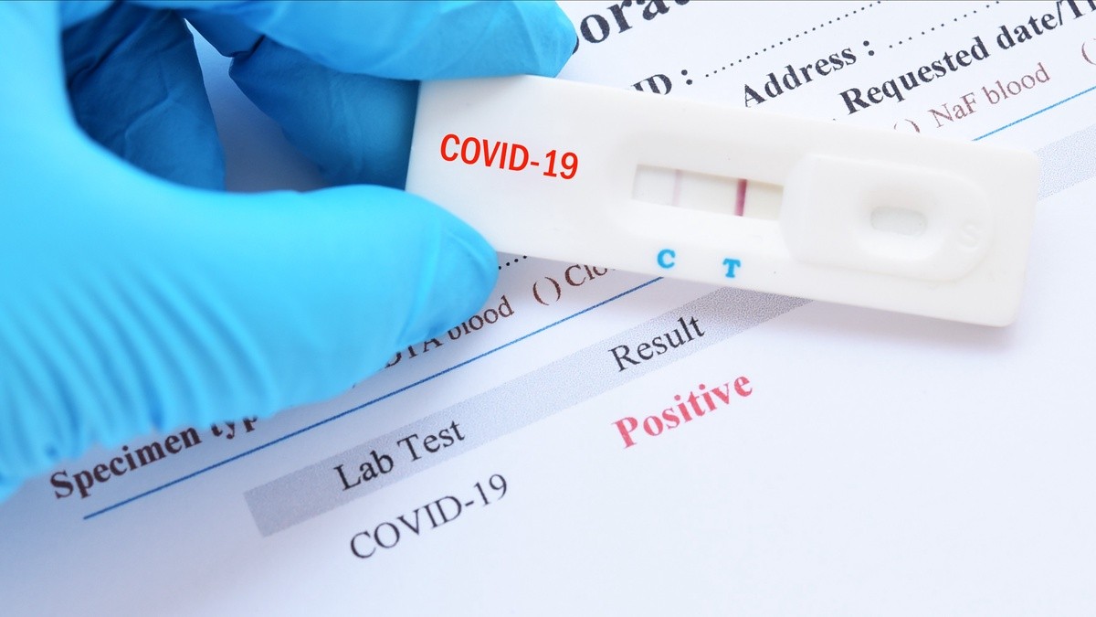 Импортировать экспресс-тесты на антитела Covid-19 разрешили без сертификации
