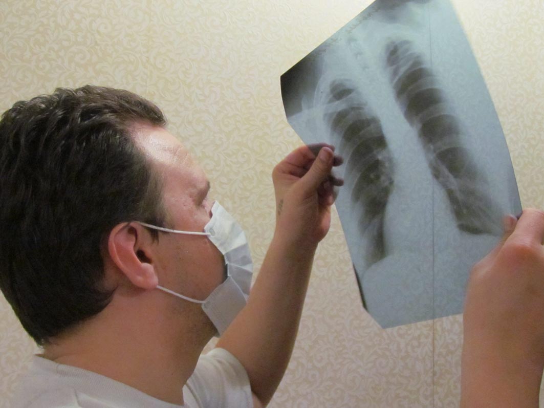 Борьба с туберкулезом усилится